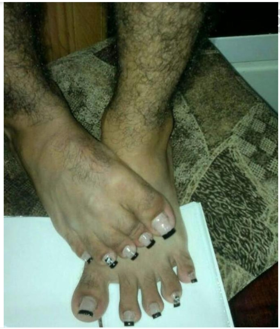 Длинный палец на ноге мужчины. Длинный педикюр. Длинные грязные ногти на ногах.