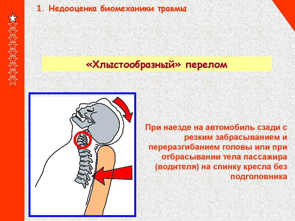 Хлыстообразная травма шейного отдела. Повреждение шеи симптомы. Травмы шеи презентация. Хлыстовой перелом шейного отдела позвоночника возникает. Повреждение шеи симптомы.