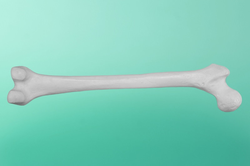 File:Femur - detail of diaphysis cross section.jpg - Wikimedia Commons